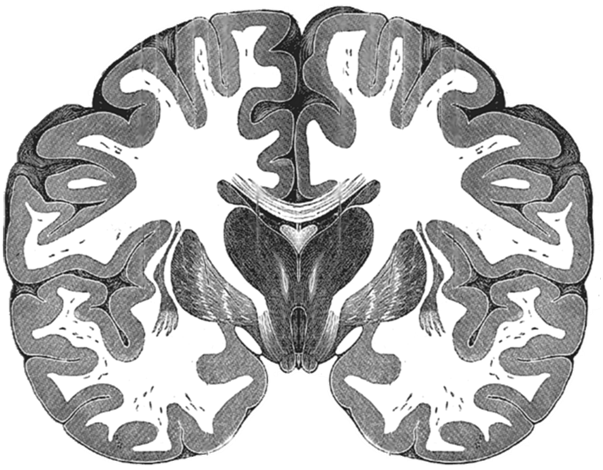 Brain coronal section showing cortical gray matter, white matter, basal ganglia, thalamus, and internal capsule